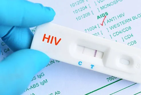 HIV Kit Manufacturers, Suppliers, Exporters in Pune from Maharashtra.